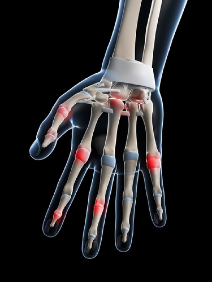 HAND